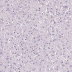 Immunohistochemical staining of human liver shows no positivity in hepatocytes as expected.
