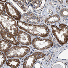 Immunohistochemical staining of human kidney shows strong granular cytoplasmic positivity in cells in tubules.