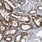 Immunohistochemical staining of human kidney shows strong granular cytoplasmic positivity in cells in tubules.
