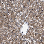 Immunohistochemical staining of human liver shows moderate granular cytoplasmic positivity in hepatocytes.