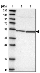 Lane 1: Marker [kDa] 230, 130, 95, 72, 56, 36, 28, 17, 11_br/_Lane 2: Human cell line RT-4_br/_Lane 3: Human cell line U-251MG sp