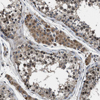 Immunohistochemical staining of human testis shows moderate granular cytoplasmic positivity in Leydig cells.
