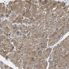 Immunohistochemical staining of human heart muscle shows moderate cytoplasmic positivity in cardiomyocytes.