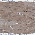 Immunohistochemical staining of human skeletal muscle shows moderate cytoplasmic positivity in myocytes.