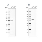 Western blot analysis using Anti-PDP1 antibody HPA021152 (A) shows similar pattern to independent antibody HPA019081 (B).