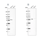 Western blot analysis using Anti-PDP1 antibody HPA021152 (A) shows similar pattern to independent antibody HPA019081 (B).