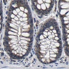 Immunohistochemical staining of human colon using Anti-EBAG9 antibody HPA021153.