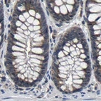 Immunohistochemical staining of human colon using Anti-EBAG9 antibody HPA021153.