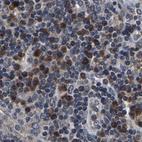 Immunohistochemical staining of human lymph node using Anti-EBAG9 antibody HPA021153.