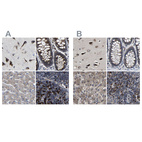 Anti-EBAG9 Antibody