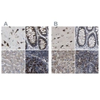 Anti-EBAG9 Antibody