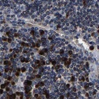 Immunohistochemical staining of human lymph node using Anti-EBAG9 antibody HPA021154.