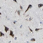 Immunohistochemical staining of human cerebral cortex using Anti-EBAG9 antibody HPA021154.