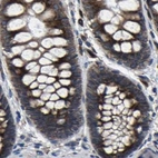 Immunohistochemical staining of human colon using Anti-EBAG9 antibody HPA021154.