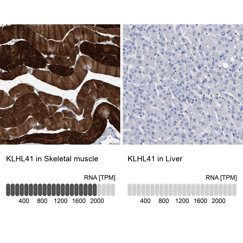 Anti-KLHL41 Antibody