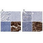 Immunohistochemical staining of human gastrointestinal, liver, lymphoid tissues and skeletal muscle using Anti-KLHL41 antibody HPA021165 (A) shows similar protein distribution across tissues to independent antibody HPA021753 (B).