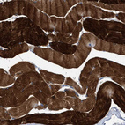 Immunohistochemical staining of human skeletal muscle shows strong cytoplasmic positivity in myocytes.