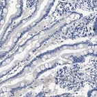 Immunohistochemical staining of human small intestine shows no positivity in glandular cells as expected.