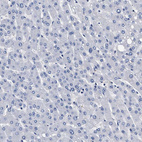 Anti-KLHL41 Antibody