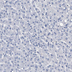 Immunohistochemical staining of human liver shows no positivity in hepatocytes as expected.