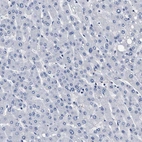 Immunohistochemical staining of human liver shows no positivity in hepatocytes as expected.