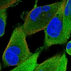 Immunofluorescent staining of human cell line RH-30 shows localization to plasma membrane & cytosol.