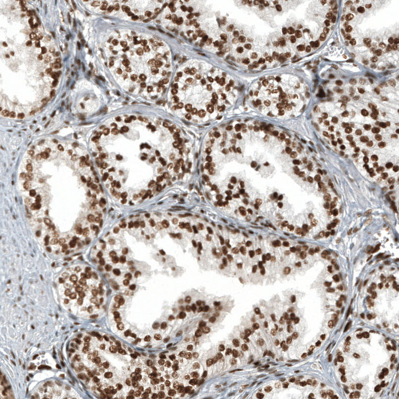 Anti-ZNF827 Antibody
