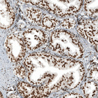 Anti-ZNF827 Antibody