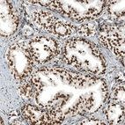 Anti-ZNF827 Antibody