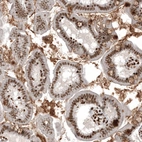 Immunohistochemical staining of human gastrointestinal shows strong nuclear positivity in glandular cells.