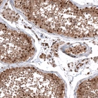 Immunohistochemical staining of human testis shows moderate nuclear positivity in Leydig cells.