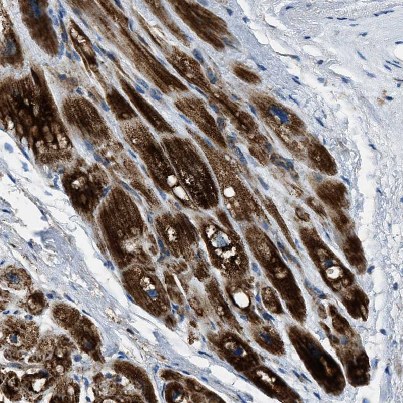 Anti-SLC25A11 Antibody