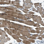 Immunohistochemical staining of human skeletal muscle shows strong cytoplasmic positivity in myocytes.