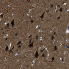 Immunohistochemical staining of human cerebral cortex shows strong granular cytoplasmic positivity in neurons.