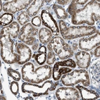 Immunohistochemical staining of human kidney shows moderate granular cytoplasmic positivity in cells in tubules.