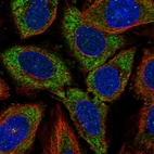 Immunofluorescent staining of human cell line SiHa shows localization to cytosol.
