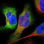 Immunofluorescent staining of human cell line U-2 OS shows localization to cytosol.