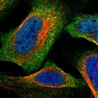 Immunofluorescent staining of human cell line U-2 OS shows localization to cytosol.