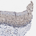 Immunohistochemical staining of human cervix, uterine shows strong granular cytoplasmic positivity in squamous epithelial cells.