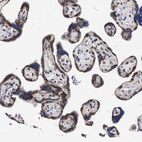 Immunohistochemical staining of human placenta shows strong granular cytoplasmic positivity in trophoblastic cells.