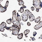 Immunohistochemical staining of human placenta shows strong granular cytoplasmic positivity in trophoblastic cells.