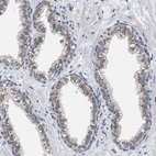 Immunohistochemical staining of human prostate shows moderate granular cytoplasmic positivity in glandular cells.