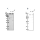 Western blot analysis using Anti-GOLGA2 antibody HPA021178 (A) shows similar pattern to independent antibody HPA021230 (B).