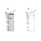 Western blot analysis using Anti-GOLGA2 antibody HPA021178 (A) shows similar pattern to independent antibody HPA021230 (B).
