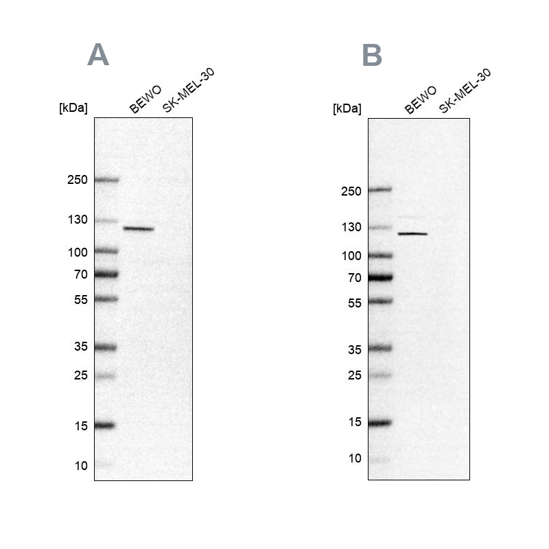 Anti-NLRP2 Antibody
