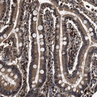 Immunohistochemical staining of human duodenum shows moderate cytoplasmic positivity in glandular cells.