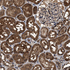 Immunohistochemical staining of human kidney shows strong cytoplasmic positivity in cells in tubules.