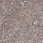 Immunohistochemical staining of human liver shows moderate cytoplasmic positivity in hepatocytes.