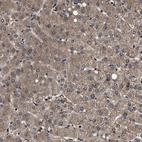 Immunohistochemical staining of human liver shows moderate cytoplasmic positivity in hepatocytes.