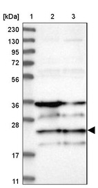 Lane 1: Marker [kDa] 230, 130, 95, 72, 56, 36, 28, 17, 11_br/_Lane 2: Human cell line RT-4_br/_Lane 3: Human cell line U-251MG sp